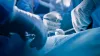 Medical Suture Needles:- Type, Usages, Benefits, and more: ext_5865086 — LiveJournal