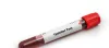 Typhidot Test: A Reliable Test to Detect Typhoid Fever - JustPaste.it