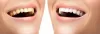 Impact Dental Care — How Get Benefited From the Invisalign Treatment