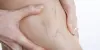 Feet Swelling Symptoms