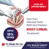 Root canal treatment in tambaram