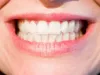 Two Best Ways To Get The White Teeth In No Time!