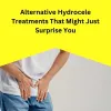 Alternative Hydrocele Treatments That Might Just Surprise You