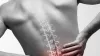  What Non-Surgical Treatment You Can Get for Low Back Pain? | paintreatment 