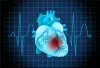 Things you must do after primary angioplasty
