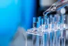 Why Legionella Testing is best conducted by Professionals