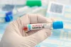 5 Reasons You Must Consider Getting a COVID-19 Antibody Test