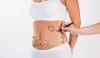 Liposuction Surgery Cost | Dr. Rajat Gupta