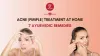  Acne (Pimple) Treatment at Home: 7 Ayurvedic Remedies