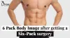 6-pack-body-image-after-getting-a-six-pack-surgery.jpeg