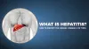 Hepatitis - How to Identify the Chronic Disease and Differentiate its Types | Hetero Healthcare