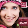 Clear Braces