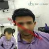 Hair Weaving in Delhi | Best Hair Weaving Clinic in New Delhi