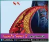 Cholesterol Kaise Kam Kare | इन चीजों को खाएं | Sachi Shiksha Hindi