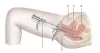 Affordable Cost Hysteroscopy at WFS Delhi India to help You Concieve!