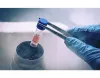 sperm freezing in delhi