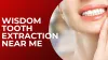 Wisdom Teeth Extraction- Important Facts to Know