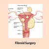 How Can You Get the Best Fibroid Surgery in Melbourne?: drgseo2018