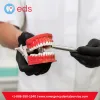 Overdenture Implants