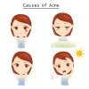 The Homo Sapien Thinks — Acne: Benefits, Treatment, and Cost