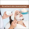 Do and Don&#8217;ts After Chemical Peeling - AAYNA Clinic