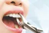 jackwatson [licensed for non-commercial use only] / What Do You need to Know About Wisdom Tooth Extraction