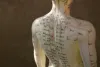 Acupuncture Therapist kentlands