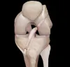 Visit Mumbai Orthosports Clinic for Acl surgery in Mumbai