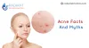 5 interesting Acne facts : Pimples, Heredity, Staying hydrated &amp; Many More