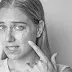 Best Skin Specialist &amp; Dermatologist in Delhi: What Causes Fungal Infections and how it can Affect Skin Health?