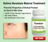 6 Natural Home Remedies for Actinic Keratosis &laquo;  Herbs Solutions by Nature