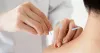 Acupuncture Therapy