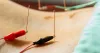 C-Section Scar Healing - 1 Amazing Treatment For Numbness