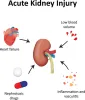 Acute Kidney Injury Treatment in Ayurveda | Kidney and Ayurveda