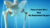 Things to Expect After a Total Hip Replacement Surgery 