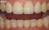 Discover Your Perfect Smile at Clarity Dental