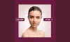 Pigmentation Treatment For Face with Advanced Laser Technology
