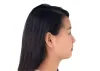 Facial Implants Houston TX | Chin Implants | Jaw and Cheek Implants
