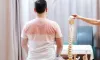 Some important things related to Vertebroplasty surgery - GoMedii