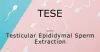 All You Need to Know About TESE! - IVF Center in Ahmedabad