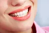 Home - URBN Dental Uptown - Quick Guide to Professional Cosmetic Teeth whitening!