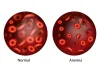 What is The Best Treatment For Anemia?