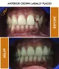 Cosmetic Smile Designing Doctor in Delhi | Smile Dentistry, Smile Makeover in Vasant Vihar, Greater Kailash