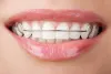 When to Consult Orthodontist for Restoring Your Smile