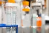 Are Superbugs the Biggest Threat to Public Health?