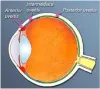 Best Uveitis Specialist | Uveitis Treatment Hospital in Delhi NCR