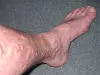 veintreatmentclinic - What Is The Science Behind The Varicose Veins?