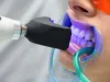Dental Implants in Ahmedabad