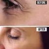 How much Does Botox Cost in Boston? Pricing at the Top MedSpas