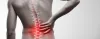 Discover Long-Term Relief for Back Pain and Sciatica with PT